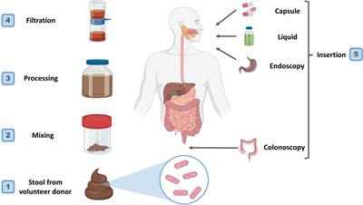 Safety and efficacy of fecal microbiota transplantation (FMT) as a modern adjuvant therapy in various diseases and disorders: a comprehensive literature review